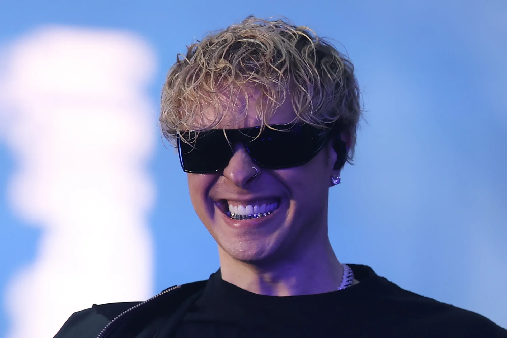 Егор Крид на каталке, но с улыбкой: как певец оказался в больнице и почему фанаты забросали его сообщениями поддержки